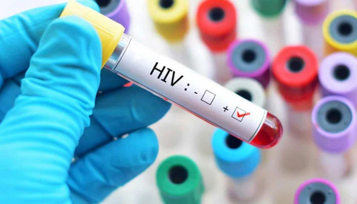 Sindh Confirms 120 HIV Cases at Karachi Hospital, Vows Legal Action
