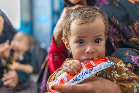 UN Warns of Deepening Child Malnutrition Crisis in Afghanistan