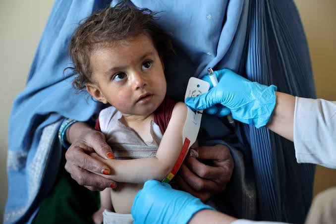 Afghanistan Hunger Deepens as 19.2 Million Face Winter Crisis